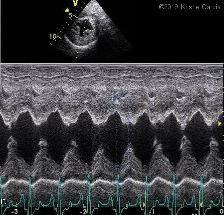 An echocardiogram showing a normal dog heart squeezing